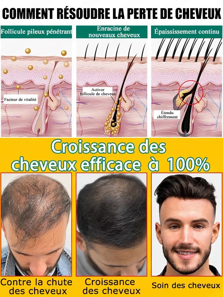Natural Ginger Hair Care Essen - đánh giá và giá Hair Care For Hair Fall