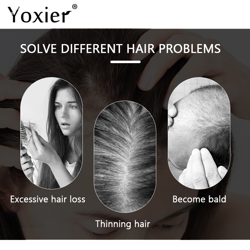 Chuyên Sâu Serum Kích Kem Ngăn - đánh giá và giá Hair Care Growth