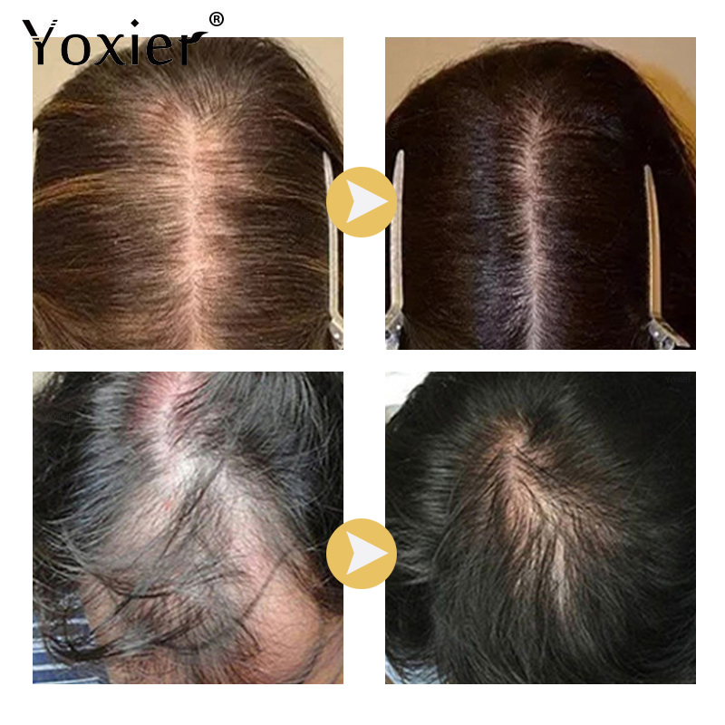 Chuyên Sâu Serum Kích Kem Ngăn - đánh giá và giá Hair Care Growth