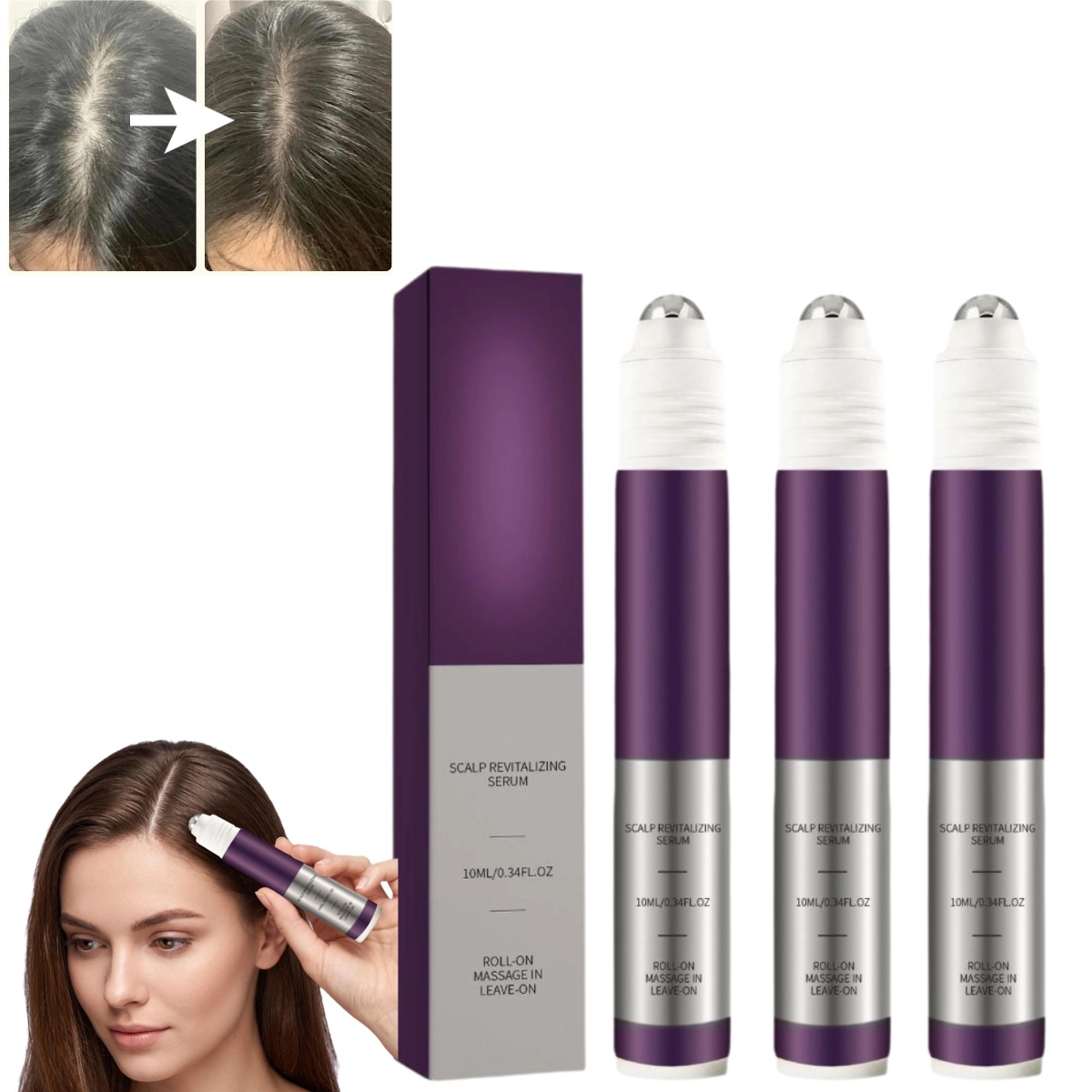 Roll‑On Scalp Revitalizing Ant - đánh giá và giá Hair Care For Hair Fall
