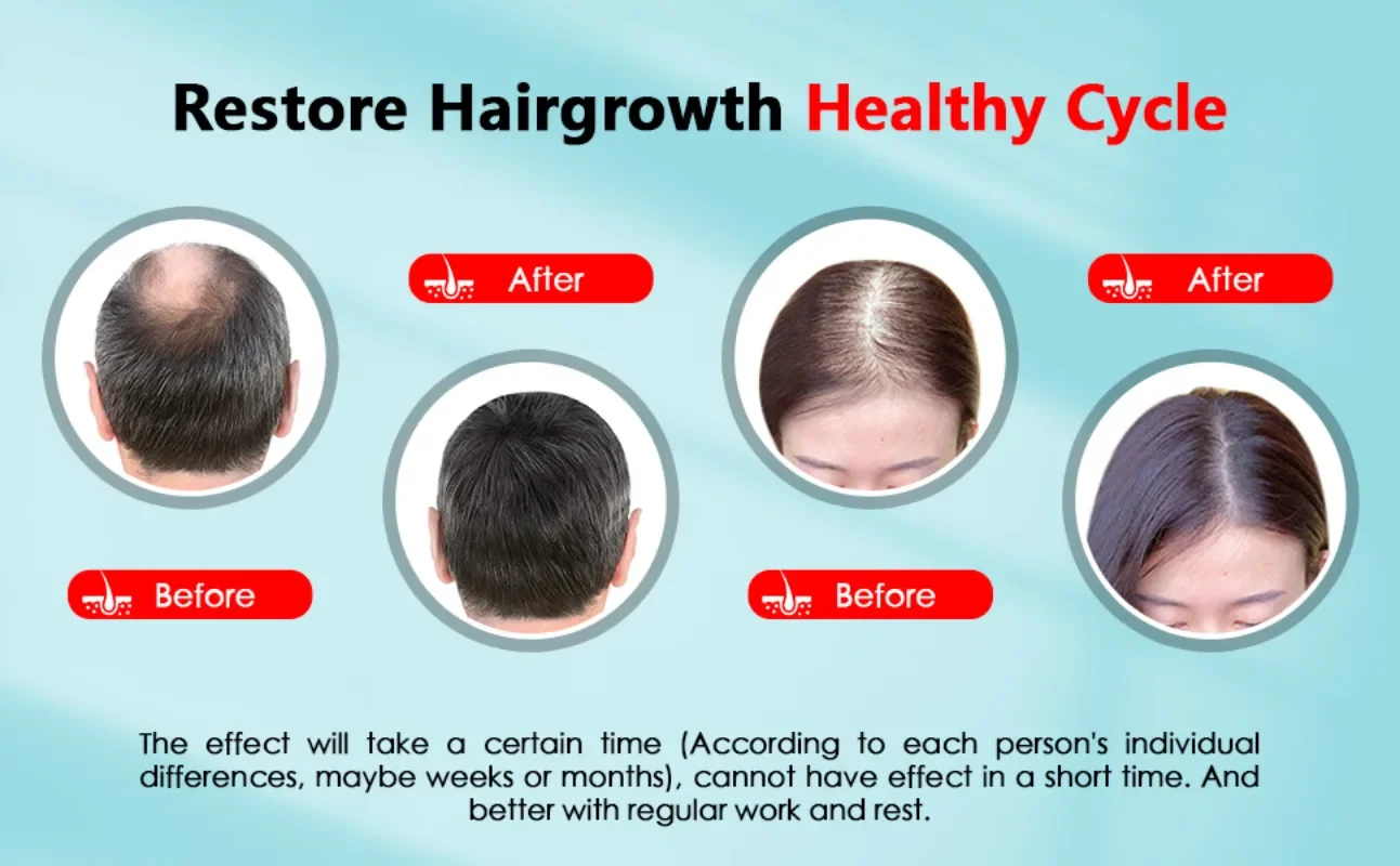 Hair Growth Cap Rechargeable 2 - đánh giá và giá Hair Care With Protein