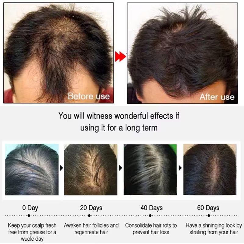 Fast Ginger Hair Growth Spray  - đánh giá và giá Hair Care Growth