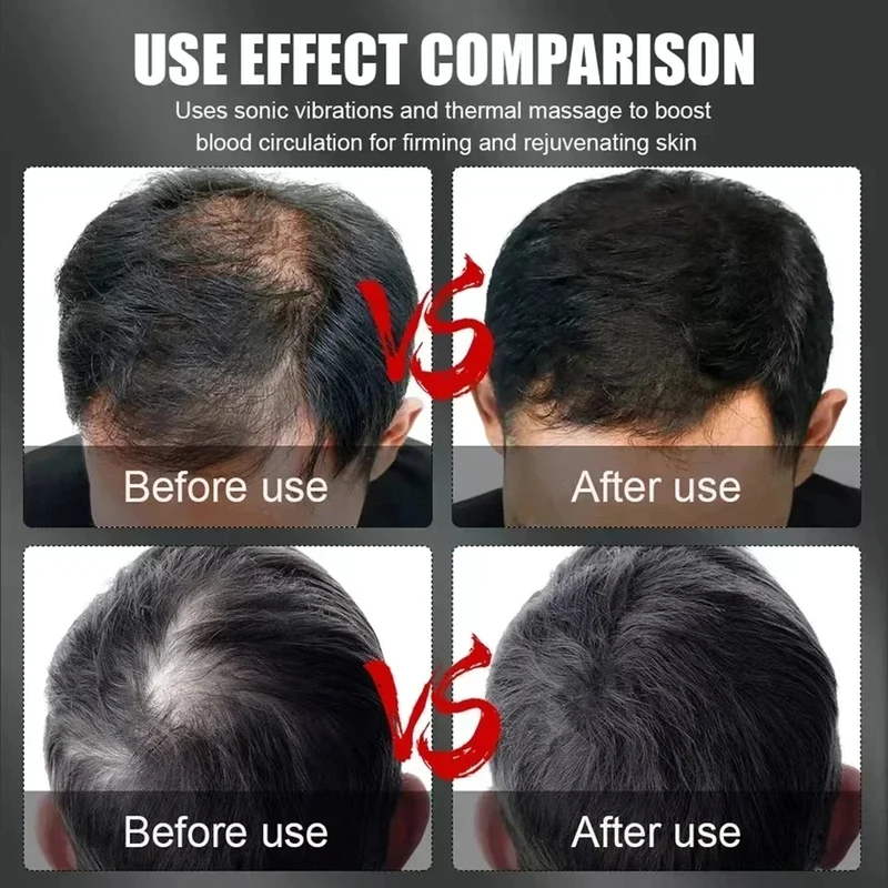 660nm 850nm Red Light Infrared - đánh giá và giá Hair Care Growth